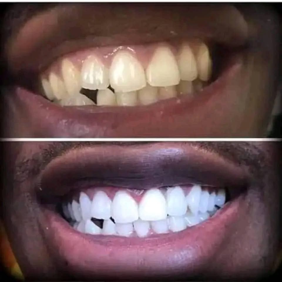 Dentifrice Sp-6 Pour La Gestion de la santé bucco-dentaire - GN