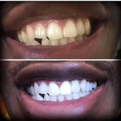 Dentifrice Sp-6 Pour La Gestion de la santé bucco-dentaire - GN